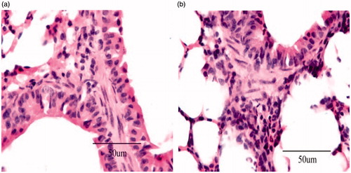 Figure 7. Histopathological studies of liver. (a) Control group and (b) NCTD microspheres.
