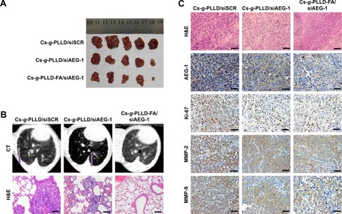 Figure 7 (A) Photographs of 143B tumors in all groups of excised tumors. (B) Representative CT scan radiographs (upper) and photographs by H&E staining (lower) of the lungs in all groups before mouse sacrifice. Lung metastatic nodules are indicated by arrows. (C) Immunohistochemical staining of AEG-1, Ki-67, MMP-2, and MMP-9 in all groups. Scale bar 100 μm.Abbreviations: CT, computed tomography; MMP, matrix metalloprotease; FA, folic acid; PLLD, poly (L-lysine) dendrons; AEG-1, astrocyte elevated gene-1; Cs-g-PLLD-FA, a novel nanoscale polysaccharide derivative prepared by click conjugation of azido-modified chitosan with propargyl focal point PLLD and subsequent coupling with FA; siSCR, scrambled small interfering RNA.