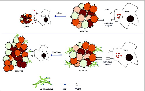 Figure 1. Fusobacterium nucleatum inhibits immune cell activity through the interaction with TIGIT. Tumor-infiltrating lymphocytes (TILs, including NK cells) are recruited to tumors, activated and commence in tumor regression. This immune response results in tumor regression (top). The Fap2 lectin expressed by fusobacteria that attach to tumors, activate TIGIT suppressive ability. TIGIT activation by fusobacteria leads to the inhibition of the TIL's cytotoxicity thus enabling tumor growth (bottom panel).
