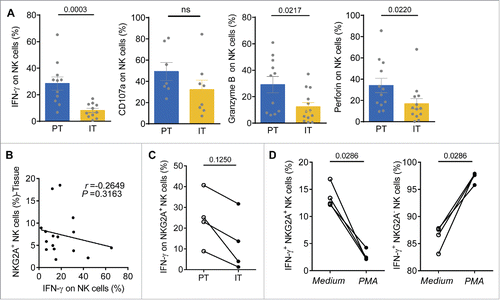 Figure 2. Functional impairment of intratumor NK cells from HCC patients. (A) TIL from PT (blue) and IT (yellow) were stimulated with IL-12, as described in the Materials and Methods. Intracellular IFNγ, CD107a, Granzyme B and perforin levels were determined using flow cytometry by gating on NK cells (CD3−CD56+) (Mann–Whitney non-parametric statistical test). (B) Analysis of the correlation between IFNγ levels and the percentage of NKG2A-expressing NK cells in the tissue samples. Each dot represents a single region (PT/IT) from an HCC patient (Spearman's correlation test). (C) The levels of IFNγ produced by NKG2A+ NK cells in IT and PT regions in paired HCC patients (Wilcoxon non-parametric statistical test). (D) Blood NK cells from the healthy controls were pre-incubated with medium alone or with PMA/ionomycin for 4 h. Intracellular IFNγ levels in NKG2A+ NK cells (Left) and NKG2A− NK cells (Right) were monitored via flow cytometry.