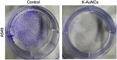 Figure 6 K-AuNCs inhibited the proliferation of A549 human lung cancer cells. Cells were assessed for proliferation with colony formation assay. Accordingly, cells were seeded on a 60-mm dish. Cells were then treated with or without K-AuNCs formulation and incubated further for 2 weeks. Cells were then stained with Crystal Violet and the number of colonies formed in control and K-AuNCs treated groups were observed. K-AuNCs treatment drastically reduced the cell proliferation and number of colonies formed by A549 human lung cancer cell line.