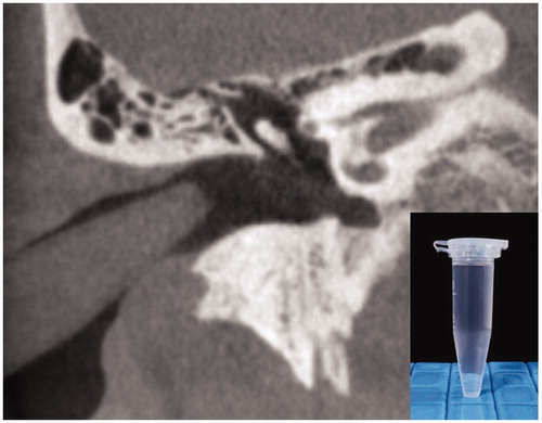 Figure 1. Polyethylene tube with full water and its inserted view of the CT image of the temporal bone.