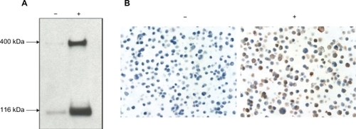 Figure 1 Specificity of the anti-Notch-1 antibody. A) Western blots. The cell lysates from full-length Notch-1-transfected Flp-In™ · T-REx™ 293 cells, both doxycycline (DOX)-uninduced (−) and induced (+) were used to test the specificity of the rabbit anti-Notch-1 antibody. The cross-reactive protein of Notch-1 transmembrane protein of full-length (300 KD) and truncated (120 KD) forms were visualized by enhanced chemiluminescence. B) Immunocytochemistry. Paraffin sections of DOX-uninduced (−) and induced (+) Notch-1-transfected Flp-In T-REx-293 cells were stained with antibody showing the membranous and cytoplasmic staining of Notch-1 in DOX-induced cells.