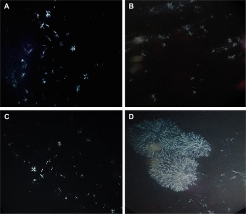 Figure 2 Cubosomes under cross-polarizing microscope (400× magnification) without stain (A) cubosomes (F3), (B) Tween-cubosomes (F6), (C) S mix cubosomes (F7), and (D) Cremophor RH 40-cubosomes (F5).Abbreviations: S mix, surfactant mixture; F, formula.