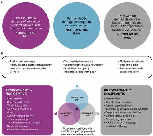 Figure 1. Classification of pain types by putative mechanisms.