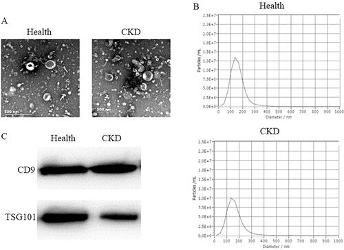 Figure 1. Urinary exosomes identification. (A) TEM image of exosomes from healthy controls and CKD patients. (B) NTA analysis of urinary exosomes. (C) Western blot showed that exosomes from healthy controls and CKD patients expressed CD9 and TSG101.