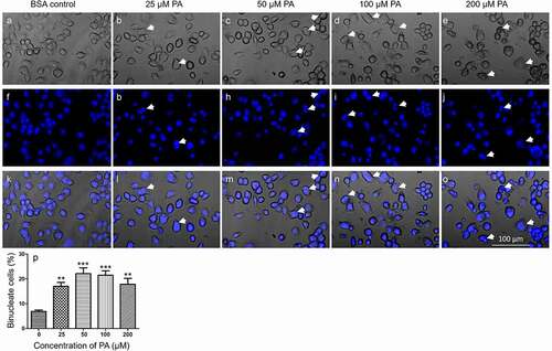 Figure 4. PA-induced accumulation of binucleate cells. N2a cells were fixed, stained with DAPI, and imaged under confocal microscope in bright-field and DAPI channels following treatment with different concentrations of PA in serum-free media for 24 h. A-O. Representative confocal microscopy images of N2a cells treated with BSA control (A, F, K), 25 μM (B, G, L), 50 μM (C, H, M), 100 μM (D, I, N), and 200 μM (E, J, O) PA with A-E representing the brightfield images, F-J representing the DAPI stained images, and K-O representing the brightfield/DAPI overlay images. Representative binucleate cells were marked by white arrows. P. Percentage of binucleate cells after treatment with different concentrations of PA for 24 h. Values presented were representative of three independent experiments (mean ± SEM). ** p < 0.01 vs. control; *** p < 0.001 vs. control.