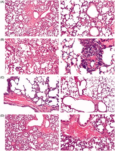 Figure 9. Representative histopathological changes in lungs obtained from mice of different groups showing the effect of CIC on: (A) control, (B) OVA-group, (C) NLP4, and (D) MDI.