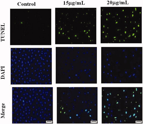 Figure 8. The Effect of AuNPs treatment on induction of apoptosis in bladder cancer cells.