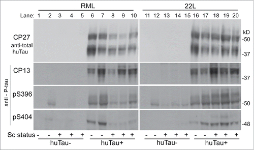 FIGURE 3. Immunoblot of brain tissue from uninfected and infected (RML and 22L) huTau− and huTau+ mice developed with 4 different anti-tau antibodies. Antibodies are indicated to the left of each row. The first row was probed with anti-total human tau antibody, CP27, and lower 3 rows were probed with antibodies specific for P-tau phosphorylation sites pS202 (CP13), pS396, and pS404 respectively. Approximate molecular weights are shown on the right of each row.