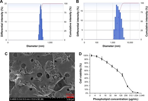 Figure 3 Characteristics of bubbles. The particle size of NBs (A) and MBs (B) measured by DLS. (C) The SEM result of NBs which are observed as hollows. (D) In vitro cytotoxicity for various phospholipid (NB’ material) concentrations determined by the CCK-8 assay. Obvious cytotoxicity appeared when the concentration reached 10 μg/mL (*P<0.05 indicates statistically significant differences compared with normal cells).