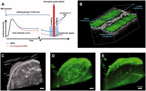 Figure 2. Ultrasound molecular imaging. (A) Timeline of the imaging protocol and schematic representation of a typical time intensity curve in the region of interest (e.g. tumour). (B) B-mode (grey) overlaid with non-linear contrast mode (green) US imaging in 3D to detect the αvβ3 expression via αvβ3-tMBs (MicroMarker) adhered to the SVEC cells (SV40-transformed murine endothelial cell line), which were cultured in an OptiCell. The band in the middle of the figure in which there is no green signal present shows the destruction of the tMBs with the flash burst. (C–E) 3D micro-UMI using VEGFR-2 Target-Ready MicroMarker on a subcutaneous human hepatocellular carcinoma tumour which was developed by injection of HuH7 cells in male nude NMRI mice. All animal work was approved by the regulatory authority of Erasmus MC and performed in compliance with the Dutch government regulation guidelines. (C) 3D B-mode US render of the tumour. (D) 3D render of contrast images 10 min after bound tMBs within the entire volume of the tumour. (E) 3D render of contrast images 10 min after injecting the control MBs. Lack of signals within the tumour indicates no attachment of control MBs to the VEGFR-2 receptors. For (B–E), imaging was performed with a Vevo 2100 US imaging system and MS250 probe at 18 MHz. The probe was moved with increments of 32 µm using a step motor (VisualSonics).