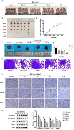 Figure 4. Curcumin has anti-tumour and -metastasis effects on subcutaneously transplanted tumours in nude mice. (A, B) Mice were sacrificed by cervical dislocation and subcutaneous tumour tissues were observed and photographed. (C). Inhibitory effect of curcumin on transplanted tumours in nude mice of each experimental group. (D, E) After sacrificing mice, lungs were collected, photographed, and fixed, and the formation of lung tumour nodules was compared between the experimental groups. (F) Lung tissue sections were observed after HE staining and photographed (×100). (G) Effect of curcumin on MMP2, MMP9, and Bclaf1 expression in HepG2 xenograft tissues in nude mice was detected by immunohistochemistry (×400). (H) Western blot analysis of curcumin effects on Wnt/β-catenin pathway protein expression in transplanted tumour tissue in nude mice. Each group compared with the vehicle group, **P < 0.01.