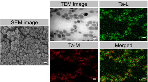 Figure 1. Morphology of PEG@mTa2O5 nanomaterials. SEM and TEM images of PEG@mTa2O5 nanomaterials. Scale bar 100 nm.