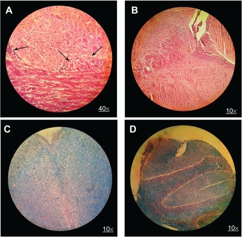 Figure 6 H&E brain staining in control group (A) and MSc1-treated mice (B); LFB staining in control group (C) and MSc1-treated mice (D).Notes: Infiltration of lymphocytes (A) and demyelination (C) in the control mice; no lymphocyte infiltration (B) or demyelination (D) in the MSc1-treated mice. Arrows show lymphocyte infiltration.Abbreviation: H&E, hematoxylin and eosin; LFB, Luxol fast blue.