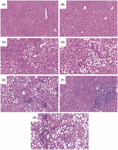 Figure 2. Representative H&E-stained liver sections. (A) Control ACD, (B) ACD/AQ, (C) Control MCD, (D) MCD/AQ, (E) PD1−/−/anti-CTLA-4/MCD, (F) PD1−/−/anti-CTLA-4/AQ, and (G) PD1−/−/anti-CTLA-4/AQ/MCD. Group identities fully defined in Figure 1 legend. Mice treated with AQ in the MCD diet and with MCD alone developed similar macro- and microvesicular steatosis. The PD1−/−/anti-CTLA-4/MCD group and the PD1−/−/anti-CTLA-4/AQ/MCD group also developed similar macro- and microvesicular steatosis.