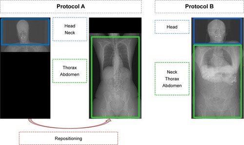 Figure 2 Sample topograms of a patient with both arm positions for Protocol A1 and with the single position for Protocol B1.