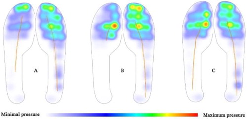 Figure 1. Distribution of foot pressure (KPa) during walking test (A: no device, B: AFO, C: FES).