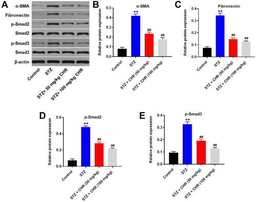 Figure 7 CHR attenuated the symptom of DN via downregulation of TGF-β signaling. (A) The protein expressions of α-SMA, Fibronectin, Smad2, p-Smad2, Smad3 and p-Smad3 in podocytes were measured by Western blot. (B) The relative expression of α-SMA was quantified by normalizing to β-actin. (C) The relative expression of Fibronectin was quantified by normalizing to β-actin. (D) The relative expression of p-Smad2 was quantified by normalizing to β-actin. (E) The relative expression of p-Smad3 was quantified by normalizing to β-actin. **P < 0.01 compared to control. ##P < 0.01 compared to STZ.