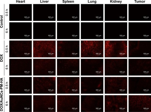 Figure 6 Fluorescence microscopy images of DOX in slices of tumors and other organs after injection (0.5 and 6 h) with normal saline (control), DOX solution (free DOX), DOX/AuNCs-PM-HA (200×).Notes: The scale bars represent 500 μm. The red fluorescence is expressed by released DOX. The tumors of DOX/AuNCs-PM-HA group were illuminated by NIR laser (1.5 W/cm2, 808 nm, 7 min) at 0.5 and 6 h postinjection, respectively.Abbreviations: AuNCs, gold nanocages; DOX, doxorubicin; DOX/AuNCs-PM-HA, DOX-loaded, PM-grafted and HA-modified AuNCs; HA, hyaluronic acid; NIR, near-infrared irradiation; PM, copolymer of N-isopropylacrylamide and acrylamide.