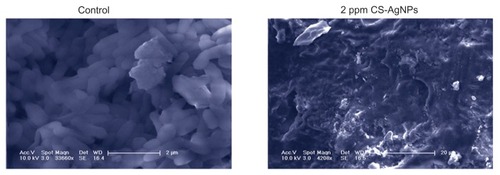 Figure 3 Scanning electron microscopy images of Pseudomonas aeruginosa after incubation with medium (control) and chitosan-stabilized silver nanoparticles (CS-AgNPs) (2 ppm) for 4 hours.Note: Scanning electron microscopy analysis was performed on a SU1510 scanning electron microscope (Hitachi, Tokyo, Japan).