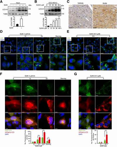 Figure 2. Sunitinib activates autophagy of cardiomyocyte. (A) Total heart tissue lysates from nude mice treated with saline or sunitinib (40 mg/kg, n = 3 per group) for 32 days were analyzed by western blots using an anti-LC3 antibody. Densitometric analysis was carried out. (B) CCC-HEH-2 cells were treated with 5 µM sunitinib for different periods of time, as indicated (between 0 and 48 h), and the expression of LC3-II was analyzed by western blot using TUBA as a loading control. Western blot was repeated for three times and densitometric analysis was carried out. (C) Heart sections were stained with LC3 antibody by immunohistochemistry. Scale bars: 25 µm. (D-E) CCC-HEH-2 cells were treated with sunitinib (0, 2.5 or 5 µM) for 24 h or sunitinib (5 µM) for 12 or 24 h or starving for 2 h. LC3 was detected by immunofluorescence staining. Scale bars: 10 µm (upper); 5 µm (lower). (F) CCC-HEH-2 cells expressing mCherry-GFP-LC3 were treated with 5 µM of sunitinib for different periods of time (0, 12 and 24 h). Autophagic flux assays was performed. (G) MCMs expressing mCherry-GFP-LC3 were treated with 5 µM sunitinib for 24 h and autophagic flux was detected. (F-G) Scale bars: 10 µm. Bottom: quantification of the percentage of mCherry-positive, GFP-positive puncta per nucleus (n = 100 cells pooled from three independent experiments). Data are presented as mean ± SD. The p value was calculated by Student’s t-test (unpaired, two-tailed, 2 groups). *: p < 0. 05, **: p < 0. 01 and ***: p < 0.001. Abbreviations: SUNI, sunitinib; MCMs, adult mouse cardiomyocyte.