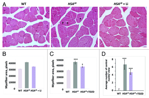 Figure 2. Correction of muscle histopathology in HSALR mice treated with GSK3 inhibitors, namely lithium and TDZD-8. (A) Hematoxylin and eosin staining of muscle sections (gastrocnemius) from age-matched 6-mo-old WT, untreated HSALR mice, and lithium-treated HSALR mice. Internal nuclei in the muscle of untreated HSALR mice are indicated by asterisks. (B) Lithium reduces myofiber size variability in HSALR mice. Myofiber area was compared in gastrocnemius from age-matched 6-mo-old WT mice and HSALR mice untreated and treated for 2 weeks with lithium. The y-axis shows the average myofiber area in pixels. p < 3.36 × 10−16 (untreated HSALR mice vs. WT mice); p < 1.10 × 10−7 (treated vs. untreated HSALR mice). (C) TDZD-8 treatment reduces myofiber size variability in HSALR muscle. Myofiber area was increased in 4-mo-old HSALR mice relative to WT mice (***p < 5.88 × 10−6). The myofiber area was reduced in HSALR mice after TDZD-8 treatment. *p < 0.02677 (treated HSALR mice vs. untreated). (D) Treatment of HSALR mice with TDZD-8 reduces the number of central nuclei in the skeletal muscle (gastrocnemius) of HSALR mice. The number of central nuclei was counted in six randomly selected 20 × views and the average values are shown. The average number of central nuclei per view was increased in HSALR mice (***p < 4.616 × 10−8) relative to WT mice. However, treatment with TDZD-8 reduced the number of central nuclei. ***p < 0.000387 (treated HSALR mice vs. untreated).