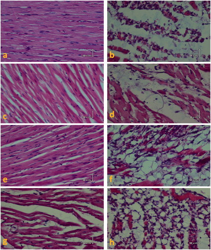 Figure 4. H&E-stained sections of heart tissue in different animal groups. The magnification of is ×200. (a) The CTL group heart sections showing normal appearance of cardiac myofibers. (c, e, and g) Sections of animals’ heart from M50, M100, and M200 groups are shown, respectively. In these groups, heart muscle appearance is associated with mild interstitial edema especially in the M200 group. (b) The ISO group section showing severe myodegeneration and necrosis of muscle fibers, interstitial edema, and inflammatory cell infiltration. (d, f, and h) Sections of heart tissues from M50 + ISO to M100 + ISO and M200 + ISO groups, respectively are shown. CTL, control; M50, the animal group which received 50 mg/kg/d of M. officinalis extract; M100, the animal group which received 100 mg/kg/d of M. officinalis extract; M200, the animal group which received 200 mg/kg/d of M. officinalis extract; ISO, isoproterenol.