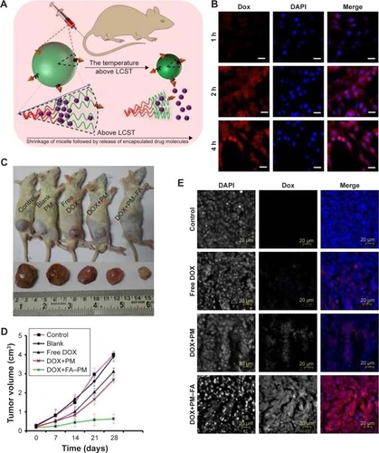 Figure 6 (A) Schematic presentation of temperature-induced shrinkage of micelles followed by drug release. (B) Fluorescence microscopic image of DOX-loaded FA-PM-treated C6 glioma cell line over a time span of 1–4 hours. The nuclei were stained with DAPI. (C) Tumor volume of the rat. (D) Variation of tumor volume with time. (E) Microscopic image of in vivo accumulation of control, free DOX, DOX-loaded PMs, and DOX-loaded FA-PMs into the tumor tissue.Notes: Fluorescence microscopies: red for DOX; blue for DAPI. Reprinted with permission from Panja S, Dey G, Bharti R, et al. Tailor-made temperature-sensitive micelle for targeted and on-demand release of anticancer drugs. ACS Appl Mater Interfaces. 2016;8(19):12063–12074.Citation72 Copyright 2016 American Chemical Society.Abbreviations: DOX, doxorubicin; FA, folate; PM, polymeric micelle; DAPI, 4′,6-diamidino-2-phenylindole; LCST, lower critical solution temperature.