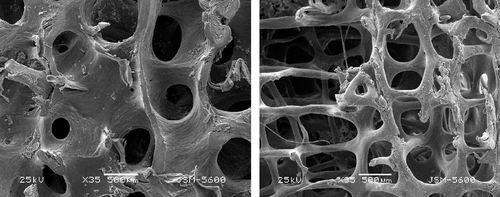 Figure 1.  Left: plate-like trabeculae. The plate-like trabeculae is the trabecular bone of the plat structure which is plate, having the irregular shape. The plate-like trabeculae can even independently form the bone marrow cavity. Right: rod-like trabeculae. The rod-shaped trabeculae are round, and have the rod-shaped structure, only constituting one wall of the marrow cavity.
