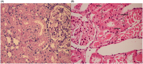Figure 2. (A) A left kidney section (H&E) in S group with a grade 0 severity score (no tubular cell damage). (B) A left kidney section (H&E) in C group with a grade 3 severity score (moderate to severe damage with 25–50% of tubular necrosis). Arrows from left to right: pyknosis, karyolysis and karyorrhexis. Images increased by 400×.