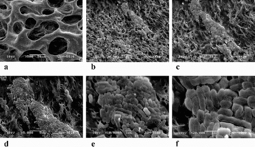 Figure 5. SEM micrography of biofilm formed on the PEO-KCM R5 biofilter. Magnification ×500 (a), ×1500 (b), ×2500 (c), ×5000 (d), ×10,000 (e) and ×20,000 (f).