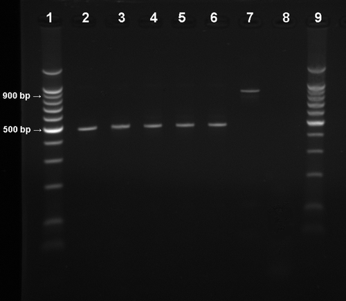 Figure 2.  Electrophoresis analysis (1.5% agarose gel) of PCR products of M. gallisepticum shedding amplified by Mycoplasma universal primers (Lauerman et al., 1995). Lanes 1 and 9, 100 base pair (bp) DNA marker (Promega Corp, Madison, Wisconsin, USA); lanes 2 to 6, unidentified Mycoplasma sp. (band size around 500 bp) from inoculated pigeon cultures; lane 7, positive M. gallisepticum sample (band size around 900 bp) from inoculated chicken culture; lane 8 = negative control.