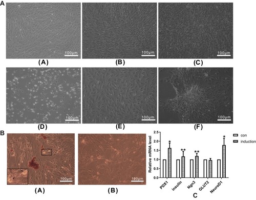 Figure 2 (A) Morphological changes of cells during IPC induction. Morphological changes of cells in the control group on days 3 (a), 6 (b) and 10 (c). Morphological changes of cells in the induction group on days 3 (d), 6 (e) and 10 (f). Morphological changes of cells were observed by inverted microscope. (B) ADSCs with DTZ staining. (a) Stained ADSC clusters in the induction group with intracellular brown particles (+) (100×magnification), and the zoom-in figure in the lower left corner (200×magnification). (b) No DTZ stained cells were found in the control group (−) (100×magnification). (c) mRNA expression changes of islet cell development–related genes in IPCs. qPCR was performed to measure the mRNA expression of islet cell development–related genes, including PDX1, Insulin, Ngn3, GLUT2 and NeuroD1. Data were shown as the mean ± SD, n = 3. Values were significantly different compared with the corresponding control value at *p<0.05 and **p<0.01.