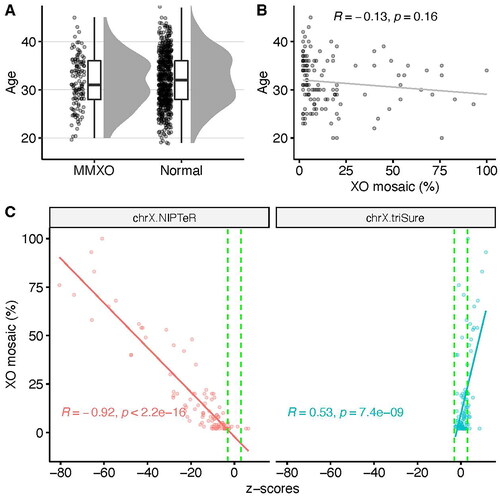 Figure 1. (A) Maternal age distribution of FISH-confirmed MMXO cases compared to normal cases. For visualization purposes, only 500 randomly selected normal cases were plotted. (B) Low correlation between maternal age and percent of maternal XO mosaicism. (C) Strong negative correlation between percent of maternal XO mosaicism and z-scores of ChrX calculated by count-based method (left panel), demonstrating the influence of maternal XO mosaicism, while the triSure method (right panel) is not sensitive to the confounding effect of maternal XO mosaicism.