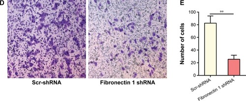 Figure 4 Fibronectin 1 knockdown inhibits the migration and invasion of K1.