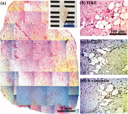 Figure 9. Crosslinking modulation of vascularized adipose tissue graft in cell-laden collagen hydrogels. 0.6% Collagen pre-polymer solutions with ECFCs and MSCs in the absence of any exogenous cytokines were subcutaneously injected into nude mice and formed cell-laden collagen hydrogels. Constructs were evaluated after 1 month in vivo. (a) The macroscopic view (inset, scale bar 5 mm) and representative H&E-stained section of entire cell-laden collagen constructs are shown (scale bar 1 mm). (b–d) High magnification of selected regions show some murine adipocytes (human-vimentin-negative) with murine vessels (human CD31-negative, blue arrows) carrying erythrocytes.
