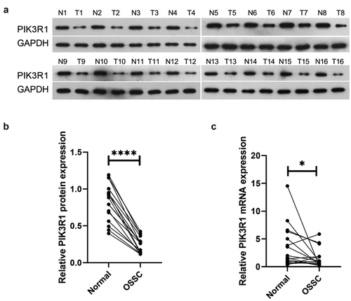 Figure 1. Decreased PIK3R1 expression in OSCC tissue
