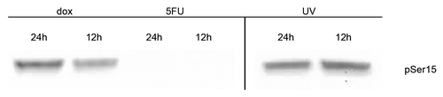 Figure 5. Detection of serine 15 phosphorylation in p53 from MCF-7 treated cells MCF-7 whole cell extracts from cells treated with doxorubicin (dox) or 5-fluorouracil (5FU) for 12 or 24 h, or treated with UV followed by incubation for 12 or 24 h, were isolated and used. Extracts containing ~120 μg total protein were separated using a polyacrylamide gel, transferred to a nitrocellulose membrane, and the membrane probed with Phosphodetect™ anti-p53 pSer15. We detect phosphorylation at serine 15 in both UV and dox treated extracts after 12 h, but do not detect the modification in 5FU treated extracts after 24 h. We estimate >6000 pg of p53 was loaded from the dox and 5FU treated extracts after 24 h of treatment, while the amount of p53 in UV treated extracts is estimated to be ~900 pg p53 based on ELISA. The p53 detection is not shown from this gel as it would overwhelm the detection.