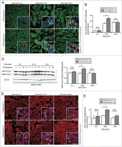 Figure 2. Starvation-induced autophagic flux peaks at 24 h in PTCs. (A and B) Autophagic flux was assessed in the proximal tubules of GFP-MAP1LC3B transgenic that were either fed or subjected to 24 or 48 h of starvation, with or without chloroquine administration 6 h before euthanasia (n = 6 to 9 in each group). Kidney sections were immunostained for LRP2/MEGALIN, a marker of proximal tubules (red), and counterstained with DAPI (blue). Arrows indicate GFP- MAP1LC3B-positive puncta. (B) The number of GFP-positive puncta per proximal tubule under each condition was counted in at least 10 high-power fields (× 600). (C) Western blot analysis using whole kidney lysates of wild-type mice that were fed or subjected to 24 or 48 h of starvation with or without chloroquine administration (n = 5 to 6 in each group). Quantification by densitometry in protein levels of MAP1LC3-II is shown. Data are expressed as the fold change relative to the mean value of fed control mice without chloroquine administration. (D) Images of staining for protein aggregates detected by ProteoStat dye in the kidney of fed and 24- or 48-h starved mice with or without chloroquine administration 6 h before euthanasia (n = 3 to 4 in each group). Counterstaining was performed with Hoechst 33342 (blue). Arrows indicate protein aggregates. (E) The number of protein aggregates per proximal tubule under each condition was counted in at least 10 high-power fields (× 600). Bars: 20 μm. Images are representative of multiple experiments. Data are provided as mean ± SE. Statistically significant differences (*P < 0.05) are indicated. n.s., not significant.