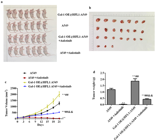 Figure 6. Galectin-1 overexpression promotes tumor growth in vivo. (a) Imaging technology to monitor the growth of A549 ×enograft tumors. (b)The growth of xenograft tumors was determined by volume. (c) The growth of xenograft tumors was determined by tumor weight. vs A549 group, **p < .01; vs A549+Anlotinib group, ##p < .01; vs gal-1 OE@HFL1:A549 group, &&p < .01.