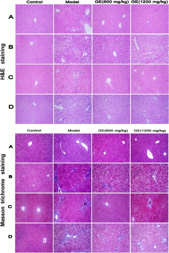 Figure 2. Histopathological changes of liver tissue in different models. Representative pictures (×200) of H&E-staining and Masson′s trichrome-staining liver sections from mice were shown. (A) acute liver injury model, (B) liver fibrosis model, (C) liver cirrhosis model, (D) the first stage in hepatocellular carcinoma.