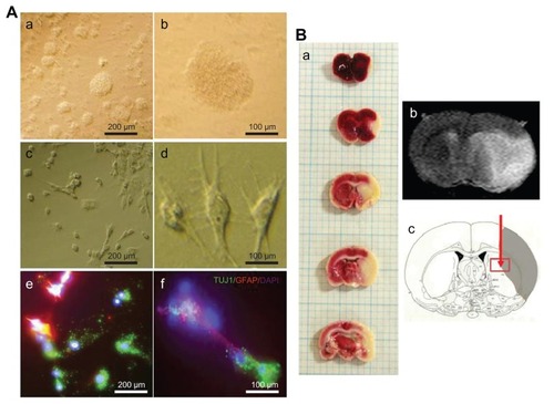 Figure 1 (A) Phase contrast images of subventricular zone neural progenitor cells and their cell lineage in vitro. The subventricular zone neural progenitor cells grown in the culture media have a neurosphere form (a and b). After two weeks of culture, the subventricular zone neural progenitor cells were differentiated primarily into neurons (60%–70%) and glial cells (c and d), which were detected by staining them with a neuronal marker (TUJ1) and an astrocyte marker (glial fibrillary acidic protein) (e and f). The nucleus of the cells was counterstained with 4′,6-diamidino-2-phenylindole. Scale bars =100 μm and 200 μm. (B) The determination of ischemic lesion and transplantation of subventricular zone neural progenitor cells in the ischemic injured brain in vivo. The infarct area after middle cerebral artery occlusion injury was verified by triphenyl tetrazolium chloride staining (a) and magnetic resonance imaging (b). The subventricular zone neural progenitor cells impregnated with carbon nanotubes were transplanted into the injured brain directly by microinjection (c).Abbreviations: DAPI, 4′,6-diamidino-2-phenylindole; GFAP, glial fibrillary acidic protein.