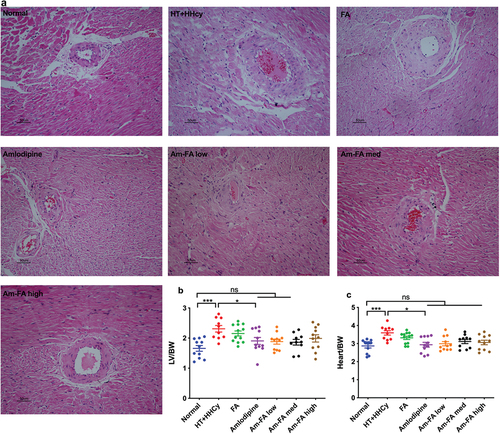 Figure 4. Histological changes in heart in response to the combination of amlodipine and FA in 2K1C rats with HHcy.