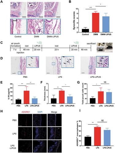 Figure 2. LIPUS significantly suppresses synovial inflammation in the DMM and air pouch mouse models. (A and B) Twelve mice were send to experiment for the first time. Two weeks later, another 12 mice were sent to the same experiment. Histopathological evaluation of the medial compartment of male C57BL/6 mouse knee joints after DMM operation with or without LIPUS treatment, and the representative images were listed (A) and the total synovitis scores following DMM surgery were calculated (B). Scale bar: 100 μm. n = 8. (C) The procedure of LIPUS treatment in LPS-induced air pouch model. The right panel shows the LIPUS device on the skin surface of air pouch. (D) Synovium-like subcutaneous air pouches of different groups were stained with H&E and black arrows represent the monocytes in the air pouch wall. Scale bars: 100 μm. (E) Supernatants from the exudate of air pouch were collected by centrifugation. IL1B levels of supernatants were measured by enzyme-linked immunosorbent assay (n = 6). (F, G) The thickness and total cells of air pouch wall were measured in each group. (H) The macrophages in air pouch wall were stained by anti-ADGRE1 (red staining) antibody. Nuclei were stained with DAPI (blue fluorescence). The dotted lines indicate the boundary of synovium. Scale bars: 200 μm. (I) The percentage of ADGRE1-positive macrophages in total cells in air pouch wall is presented. S represents synovium. The above statistical analyses were performed using two-way ANOVA followed by Bonferroni’s multiple comparisons test. *p < 0.05, **p < 0.01, ***p < 0.001, NS, not significant.