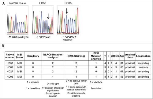 Figure 3. NLRC5 mutations in MSI tumor samples. A. Representative sequencing results spanning the C6 coding microsatellite in the NLRC5 coding region. B. Information about NLRC5-mutated tumors.