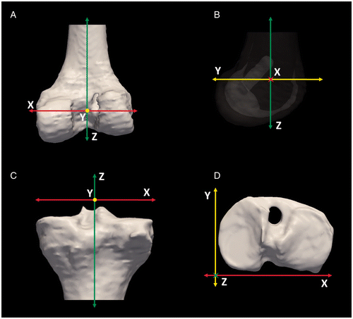 Figure 2. The standardized orientations of the femur and tibia. For the femur, the Z-axis is aligned with the femoral diaphysis (A) and the X-axis is defined by a line that allows the medial and lateral condyles to be aligned as in a perfect lateral 2D radiograph (B). (The figure demonstrates a femur with modified transparency to allow visualization of the overlap.) For the tibia, the X-axis is aligned with the medial-lateral slope of the tibial plateau (C) and the Z-axis is aligned such that the posterior-most aspects of the medial and lateral condyles of the tibial plateau are linearly aligned (D).