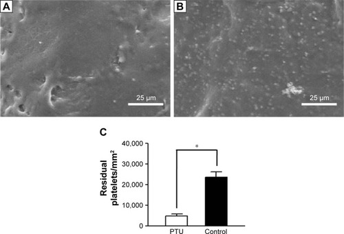 Figure 3 Platelet adhesion test in vitro.Notes: Fabricated nanofibers with (A) or without (B) a PTU loading (25 μg/mm2) were immersed in platelet-rich plasma for 3 hours, and the platelets adherent to the fibers were then counted and averaged (C). Magnification ×500. Each value represents the mean ± SE of four independent experiments. *Represents significant difference.Abbreviations: PTU, propylthiouracil; SE, standard error.