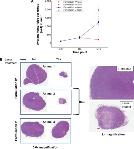 Figure 8 Tumor regression in liposomes injected mice upon laser treatment.Notes: (A) Liposomes were injected in the mice and the animals were monitored for tumor regression up to 15 days. Tumor volumes were measured and data were averaged per group (n=4). D-6: six days prior to liposome injection and treatment; D0: liposome injection and treatment; D15: 15 days after liposome injection and treatment. (B) Histopathology analysis of tumors: xenografts were fixed in 10% neutral buffered formalin, routinely processed, paraffin-embedded, sectioned at 5 μm, and stained with hematoxylin and eosin (H&E). Stained sections were scanned into digital format via an AperoScanScope XT whole slide scanner at 40× magnification. Extractions to tiff format were done at various magnifications. A 0.1 mm scale bar is present within each image. All evaluations were performed by a board-certified veterinary pathologist.