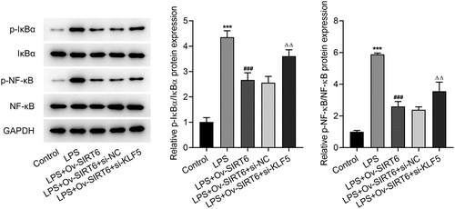 Figure 6 KLF5-mediated SIRT6 inhibited the NF-κB pathway.